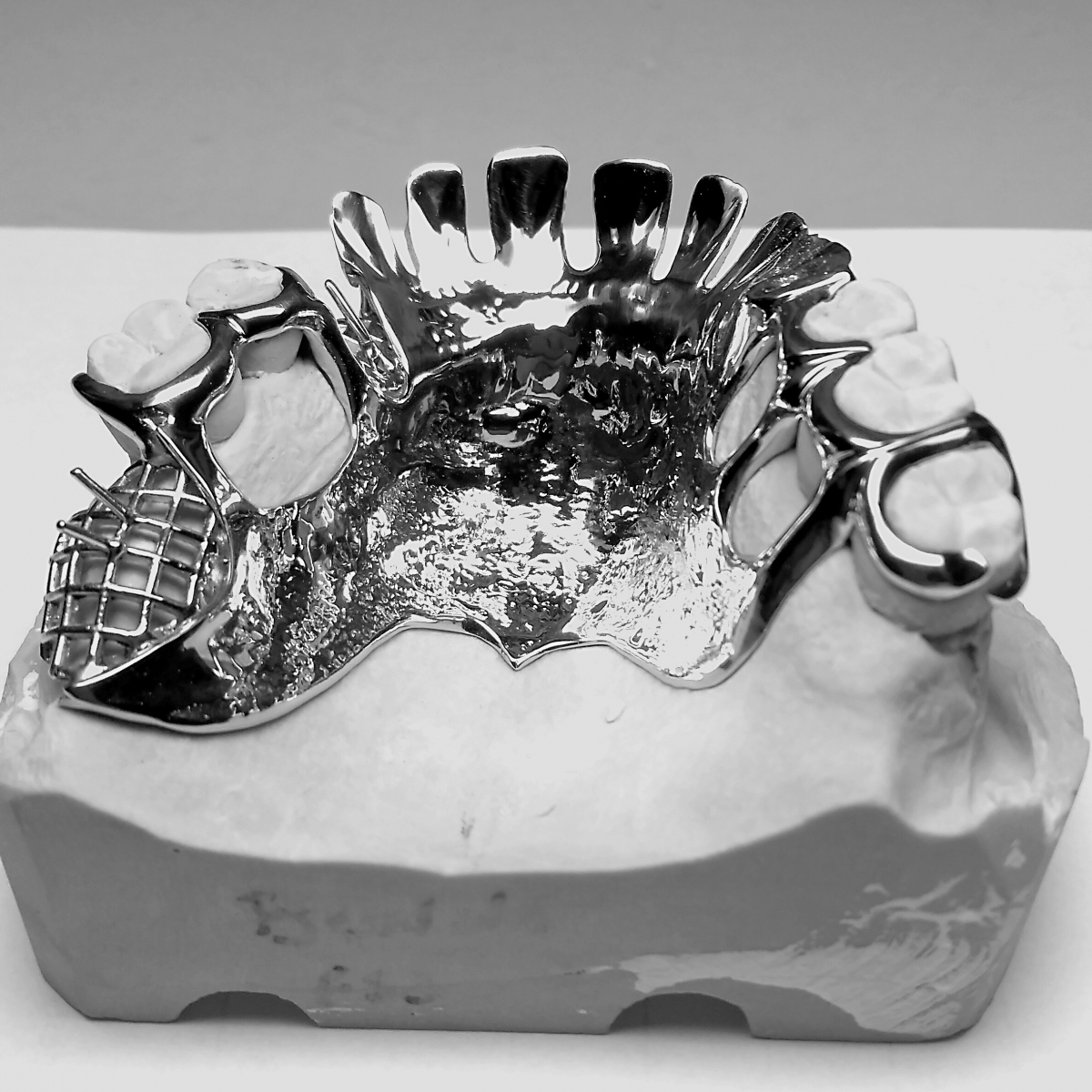 Châssis métallique (stellite) dentaire Laboratoire Simon N